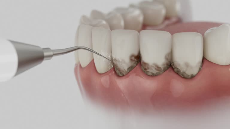 Reliable Dental Implants contractor in Colchester, IL by Smile Center Dentistry